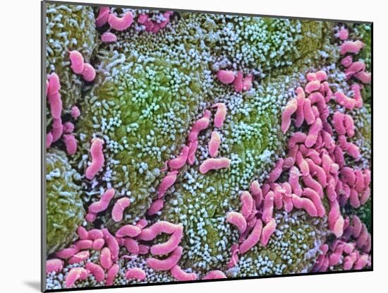 Helicobacter Pylori Bacteria In Stomach-null-Mounted Photographic Print