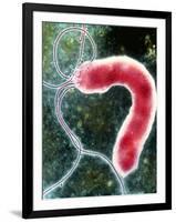 Helicobacter Pylori Bacterium-NIBSC-Framed Photographic Print