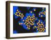 Hepatitis a Viruses, TEM-Dr. Linda Stannard-Framed Photographic Print