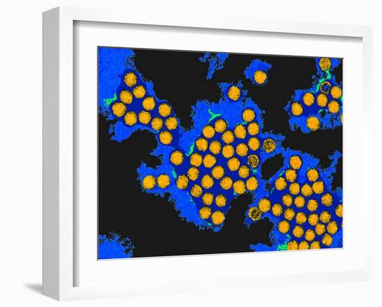 Hepatitis a Viruses, TEM-Dr. Linda Stannard-Framed Photographic Print