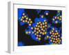 Hepatitis a Viruses, TEM-Dr. Linda Stannard-Framed Photographic Print