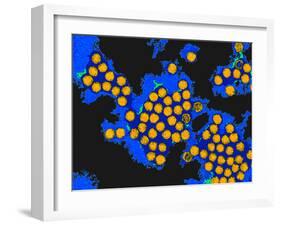 Hepatitis a Viruses, TEM-Dr. Linda Stannard-Framed Photographic Print