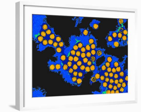 Hepatitis a Viruses, TEM-Dr. Linda Stannard-Framed Photographic Print