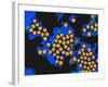 Hepatitis a Viruses, TEM-Dr. Linda Stannard-Framed Photographic Print