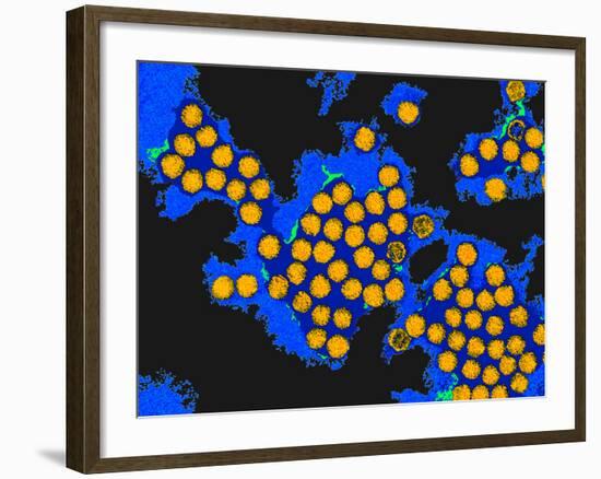 Hepatitis a Viruses, TEM-Dr. Linda Stannard-Framed Photographic Print