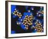 Hepatitis a Viruses, TEM-Dr. Linda Stannard-Framed Photographic Print