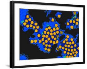 Hepatitis a Viruses, TEM-Dr. Linda Stannard-Framed Photographic Print