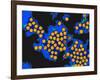 Hepatitis a Viruses, TEM-Dr. Linda Stannard-Framed Photographic Print