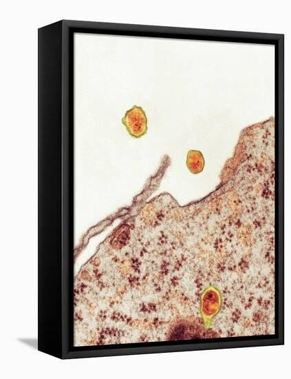 Hepatitis C Viruses, TEM-Thomas Deerinck-Framed Stretched Canvas