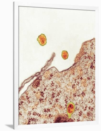 Hepatitis C Viruses, TEM-Thomas Deerinck-Framed Photographic Print