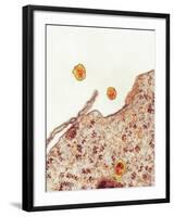 Hepatitis C Viruses, TEM-Thomas Deerinck-Framed Photographic Print