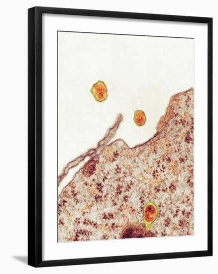 Hepatitis C Viruses, TEM-Thomas Deerinck-Framed Photographic Print