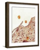 Hepatitis C Viruses, TEM-Thomas Deerinck-Framed Photographic Print