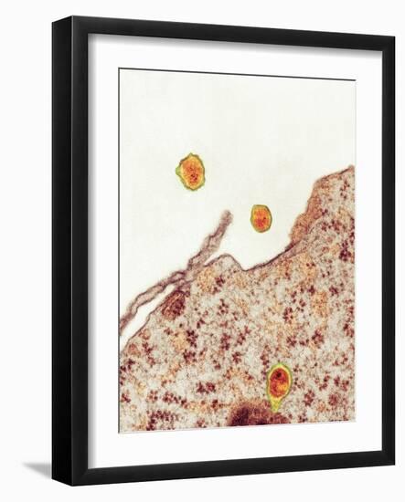 Hepatitis C Viruses, TEM-Thomas Deerinck-Framed Photographic Print