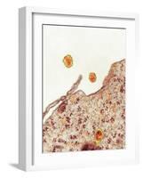 Hepatitis C Viruses, TEM-Thomas Deerinck-Framed Photographic Print