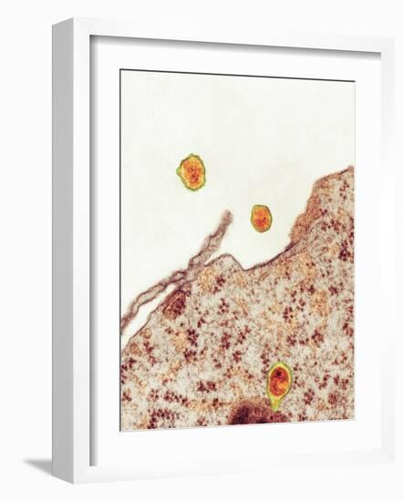 Hepatitis C Viruses, TEM-Thomas Deerinck-Framed Photographic Print