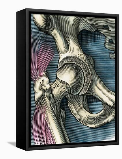 Hip Joint, Artwork-Bill Sanderson-Framed Stretched Canvas