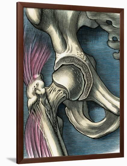 Hip Joint, Artwork-Bill Sanderson-Framed Photographic Print