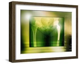 Hip Replacement, X-ray-Miriam Maslo-Framed Photographic Print