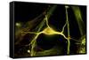 Hippocampal Neuron Fluorescent Micrograph-Robert Mcneil-Framed Stretched Canvas