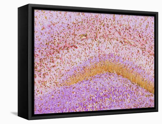 Hippocampus Brain Tissue-Thomas Deerinck-Framed Stretched Canvas