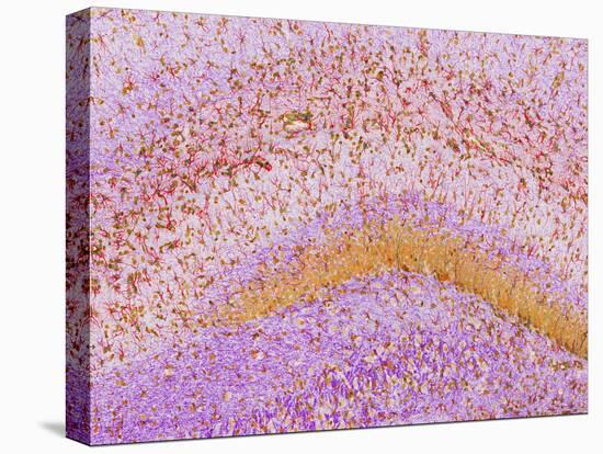 Hippocampus Brain Tissue-Thomas Deerinck-Stretched Canvas