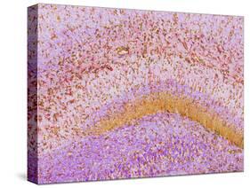 Hippocampus Brain Tissue-Thomas Deerinck-Stretched Canvas