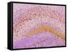 Hippocampus Brain Tissue-Thomas Deerinck-Framed Stretched Canvas