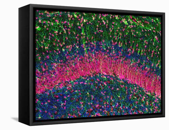 Hippocampus Brain Tissue-Thomas Deerinck-Framed Stretched Canvas