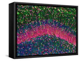 Hippocampus Brain Tissue-Thomas Deerinck-Framed Stretched Canvas