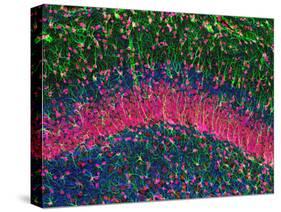 Hippocampus Brain Tissue-Thomas Deerinck-Stretched Canvas