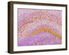 Hippocampus Brain Tissue-Thomas Deerinck-Framed Photographic Print