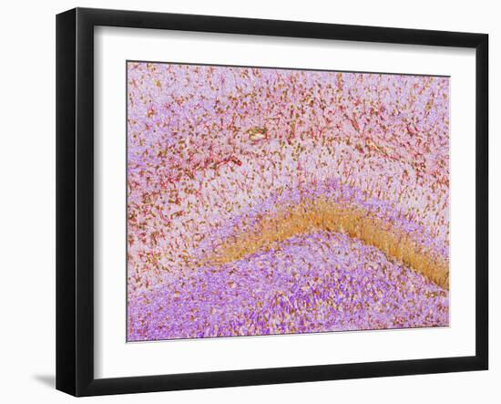 Hippocampus Brain Tissue-Thomas Deerinck-Framed Photographic Print