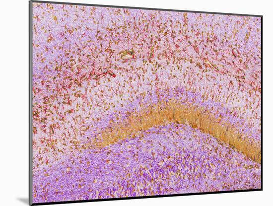 Hippocampus Brain Tissue-Thomas Deerinck-Mounted Photographic Print