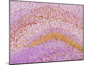 Hippocampus Brain Tissue-Thomas Deerinck-Mounted Photographic Print