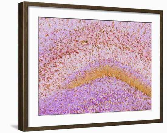 Hippocampus Brain Tissue-Thomas Deerinck-Framed Photographic Print