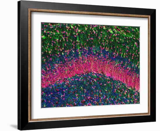 Hippocampus Brain Tissue-Thomas Deerinck-Framed Photographic Print