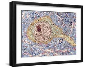 Hippocampus Neuron, TEM-Thomas Deerinck-Framed Photographic Print