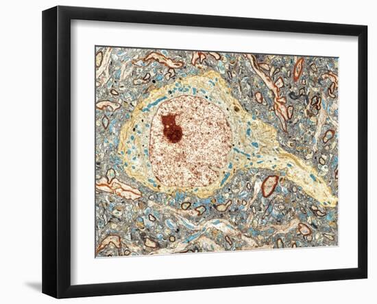 Hippocampus Neuron, TEM-Thomas Deerinck-Framed Photographic Print