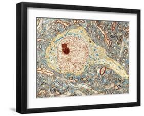 Hippocampus Neuron, TEM-Thomas Deerinck-Framed Photographic Print