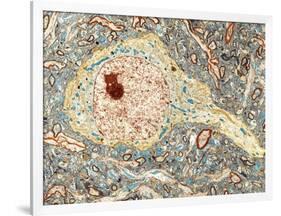 Hippocampus Neuron, TEM-Thomas Deerinck-Framed Photographic Print