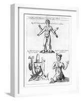 Historical Birth Deformities-Science, Industry and Business Library-Framed Photographic Print