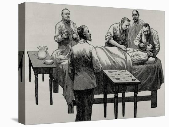 History of Medicine, Chloroform Anesthesia, 19th Century-null-Stretched Canvas