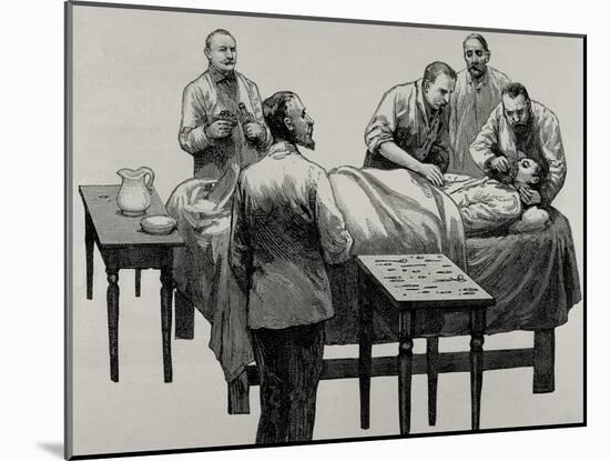 History of Medicine, Chloroform Anesthesia, 19th Century-null-Mounted Giclee Print