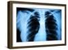 Human Body's Radiograph-Sergieiev-Framed Art Print