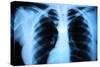 Human Body's Radiograph-Sergieiev-Stretched Canvas