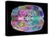 Human Brain, Computer Artwork-PASIEKA-Stretched Canvas