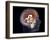 Human Brain, MRI Scan-null-Framed Photographic Print