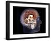 Human Brain, MRI Scan-null-Framed Photographic Print