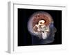 Human Brain, MRI Scan-null-Framed Photographic Print